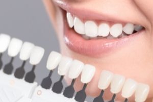 3D Veneers Package photo by Uptodate Medicare Centre