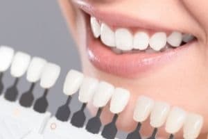 Dental veneers and laminates at Uptodate Medicare Centre in Dubai